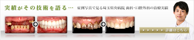 実績がその技術を語る…症例写真で見る埼玉県央病院 歯科・口腔外科の治療実績